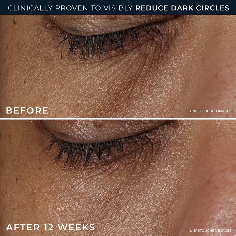 New - RoC Derm Correxion Dark Circle Eye Repair Cream - 15ml